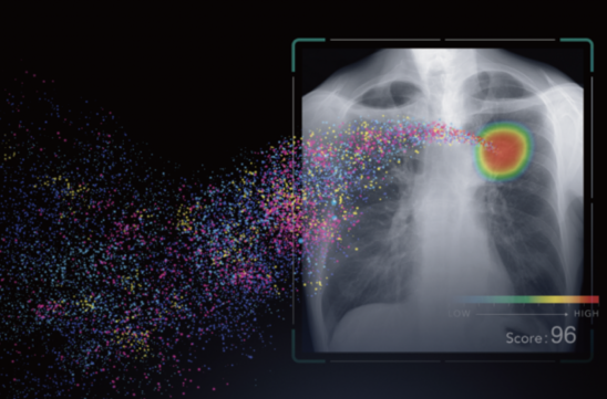 CXR-AID